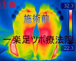 ���ڃ}�b�T�[�W�O�̑������x