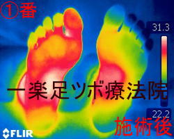 ���ڃ}�b�T�[�W��̑����̉��x