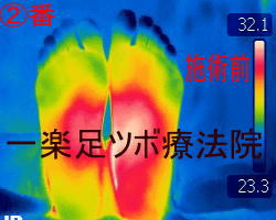 ���ڃ}�b�T�[�W����O�̑����̉��x