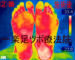 ���ڃ}�b�T�[�W�{�p��̑����̉��x