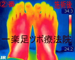 ���ڃ}�b�T�[�W�{�p��̑��b�̉��x