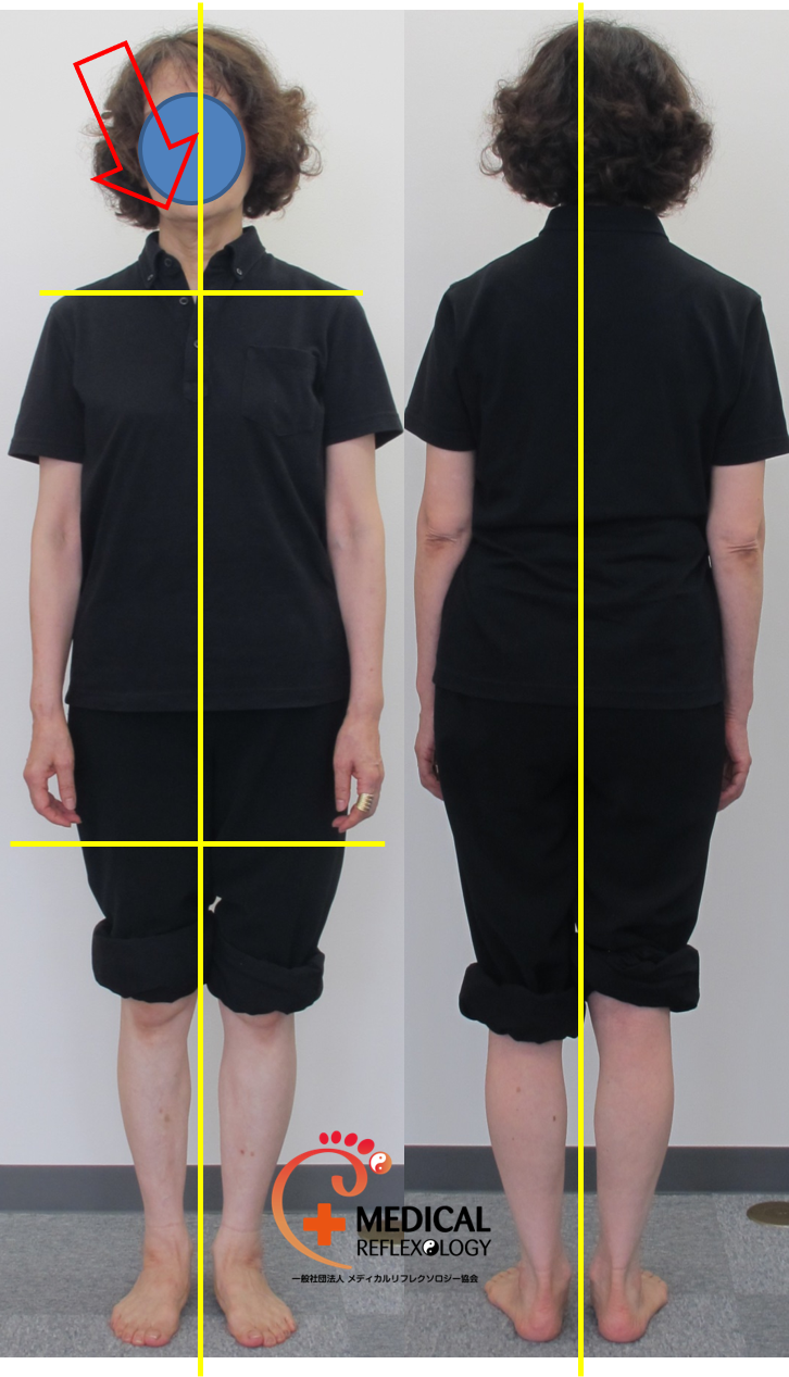足つぼマッサージと姿勢の関係