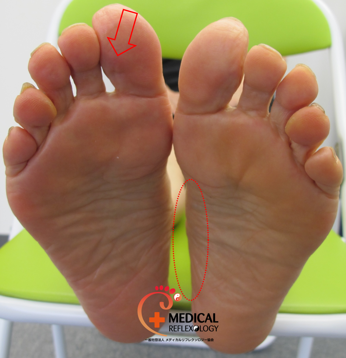 足つぼマッサージの研究